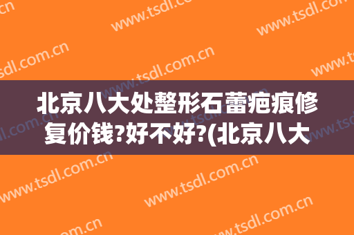 北京八大处整形石蕾疤痕修复价钱?好不好?(北京八大处治疗疤痕怎么样)