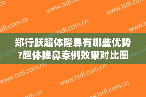 郑行跃超体隆鼻有哪些优势?超体隆鼻案例效果对比图_好大夫工作室