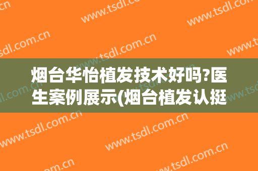 烟台华怡植发技术好吗?医生案例展示(烟台植发认挺华怡)
