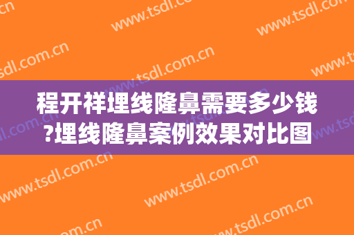 程开祥埋线隆鼻需要多少钱?埋线隆鼻案例效果对比图_上海交通大学医学院附属第九人民医院