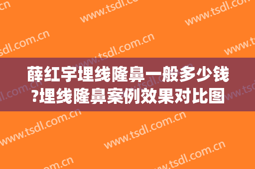 薛红宇埋线隆鼻一般多少钱?埋线隆鼻案例效果对比图_北京大学第三医院