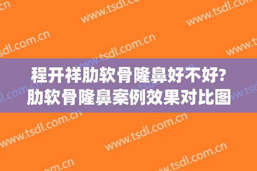 程开祥肋软骨隆鼻好不好?肋软骨隆鼻案例效果对比图_上海交通大学医学院附属第九人民医院