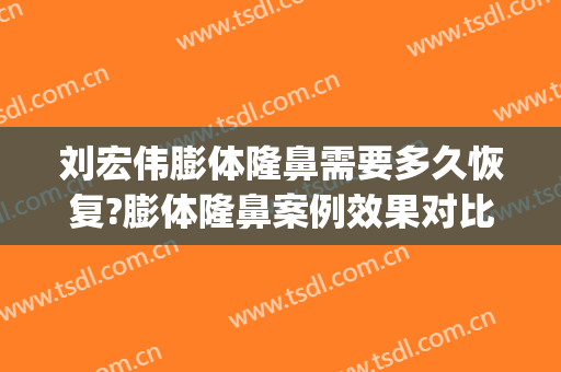 刘宏伟膨体隆鼻需要多久恢复?膨体隆鼻案例效果对比图_暨南大学附属第一医院