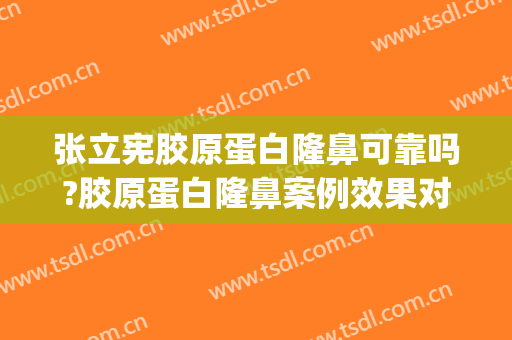 张立宪胶原蛋白隆鼻可靠吗?胶原蛋白隆鼻案例效果对比图_南方医科大学南方医院