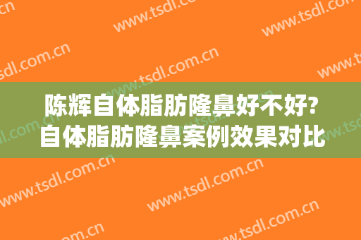 陈辉自体脂肪隆鼻好不好?自体脂肪隆鼻案例效果对比图_上海交通大学医学院附属第九人民医院