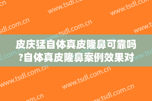 皮庆猛自体真皮隆鼻可靠吗?自体真皮隆鼻案例效果对比图_上海交通大学医学院附属仁济医院