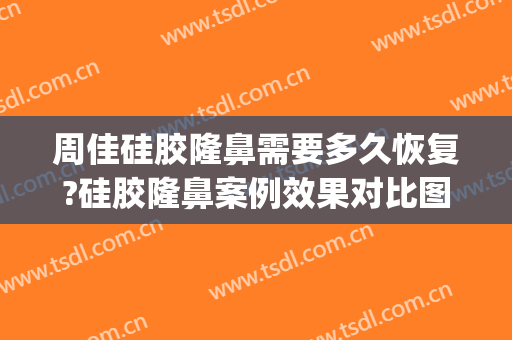 周佳硅胶隆鼻需要多久恢复?硅胶隆鼻案例效果对比图_上海交通大学医学院附属第九人民医院