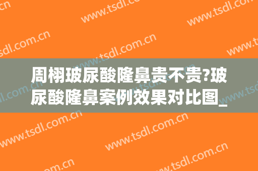 周栩玻尿酸隆鼻贵不贵?玻尿酸隆鼻案例效果对比图_中国医学科学院整形外科医院