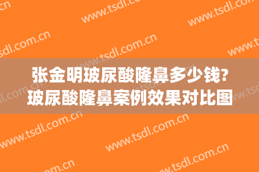 张金明玻尿酸隆鼻多少钱?玻尿酸隆鼻案例效果对比图_中山大学孙逸仙纪念医院