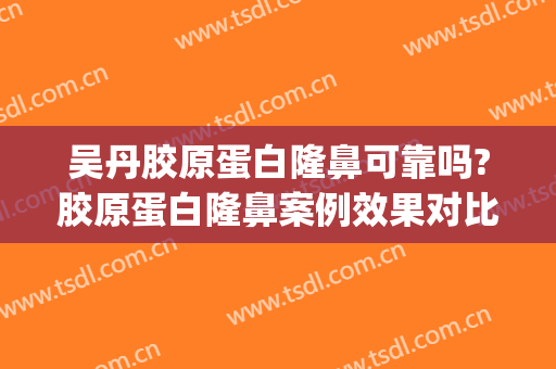 吴丹胶原蛋白隆鼻可靠吗?胶原蛋白隆鼻案例效果对比图_复旦大学附属眼耳鼻喉科医院