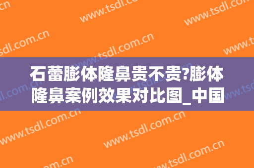 石蕾膨体隆鼻贵不贵?膨体隆鼻案例效果对比图_中国医学科学院整形外科医院