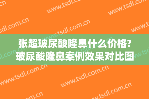 张超玻尿酸隆鼻什么价格?玻尿酸隆鼻案例效果对比图_中国医学科学院整形外科医院
