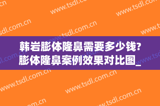 韩岩膨体隆鼻需要多少钱?膨体隆鼻案例效果对比图_中国人民解放军总医院第一医学中心