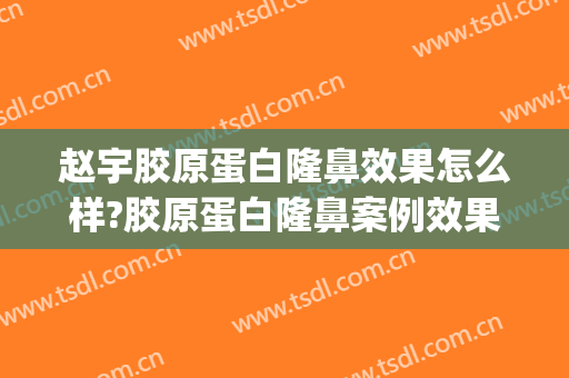 赵宇胶原蛋白隆鼻效果怎么样?胶原蛋白隆鼻案例效果对比图_安徽医科大学第一附属医院