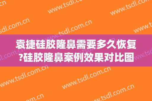 袁捷硅胶隆鼻需要多久恢复?硅胶隆鼻案例效果对比图_上海交通大学医学院附属第九人民医院