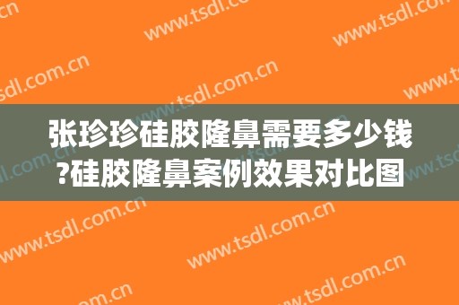张珍珍硅胶隆鼻需要多少钱?硅胶隆鼻案例效果对比图_复旦大学附属眼耳鼻喉科医院