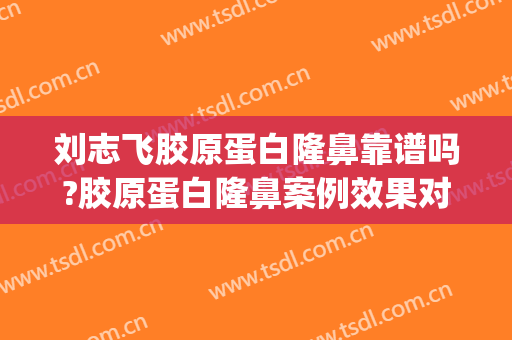 刘志飞胶原蛋白隆鼻靠谱吗?胶原蛋白隆鼻案例效果对比图_中国医学科学院北京协和医院