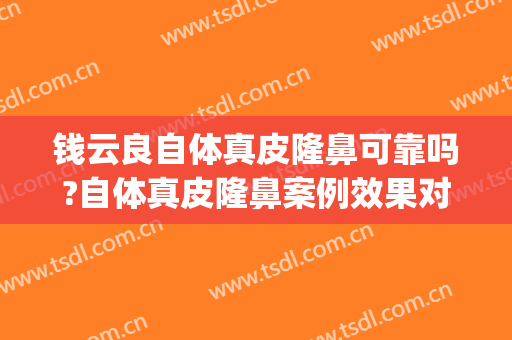 钱云良自体真皮隆鼻可靠吗?自体真皮隆鼻案例效果对比图_上海交通大学医学院附属第九人民医院