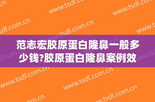 范志宏胶原蛋白隆鼻一般多少钱?胶原蛋白隆鼻案例效果对比图_上海交通大学医学院附属仁济医院