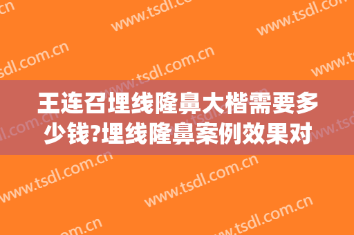 王连召埋线隆鼻大楷需要多少钱?埋线隆鼻案例效果对比图_中国医学科学院整形外科医院