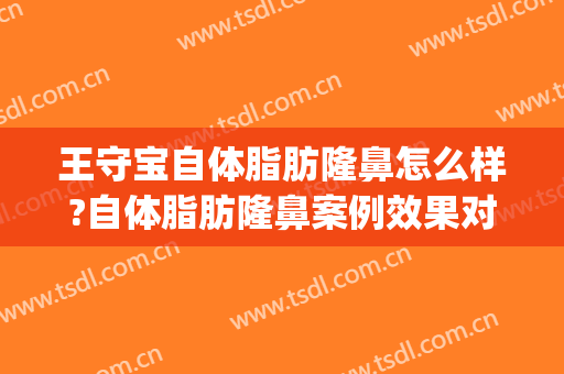 王守宝自体脂肪隆鼻怎么样?自体脂肪隆鼻案例效果对比图_上海交通大学医学院附属第九人民医院