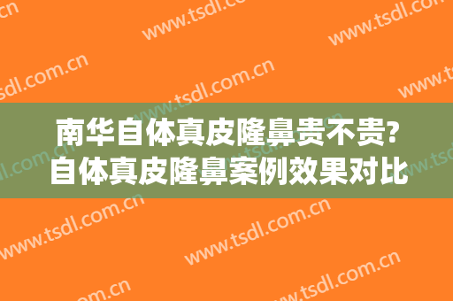 南华自体真皮隆鼻贵不贵?自体真皮隆鼻案例效果对比图_广州医科大学附属第五医院