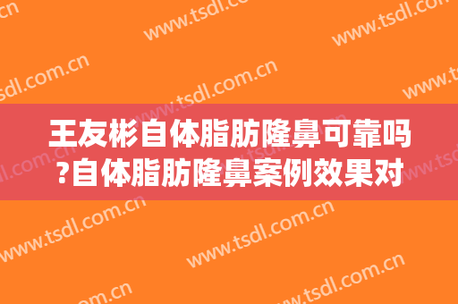 王友彬自体脂肪隆鼻可靠吗?自体脂肪隆鼻案例效果对比图_中国医学科学院北京协和医院