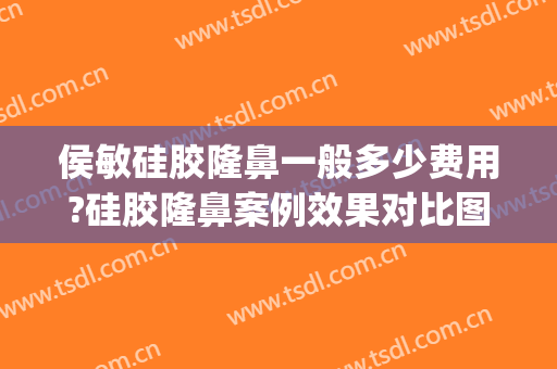 侯敏硅胶隆鼻一般多少费用?硅胶隆鼻案例效果对比图_天津市口腔医院