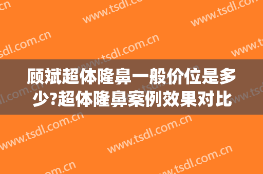 顾斌超体隆鼻一般价位是多少?超体隆鼻案例效果对比图_上海交通大学医学院附属第九人民医院