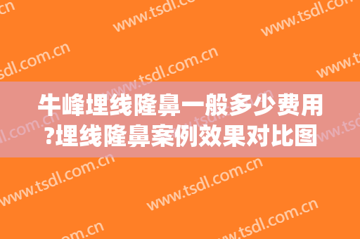 牛峰埋线隆鼻一般多少费用?埋线隆鼻案例效果对比图_中国医学科学院整形外科医院