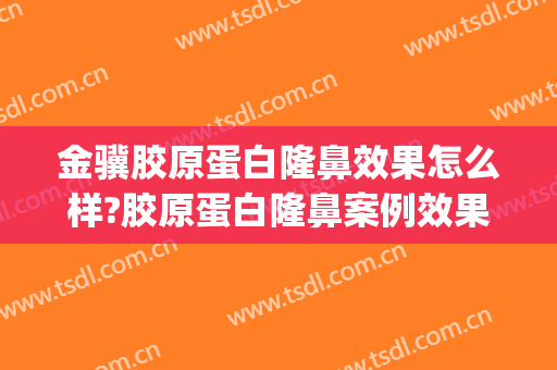 金骥胶原蛋白隆鼻效果怎么样?胶原蛋白隆鼻案例效果对比图_中国医学科学院整形外科医院
