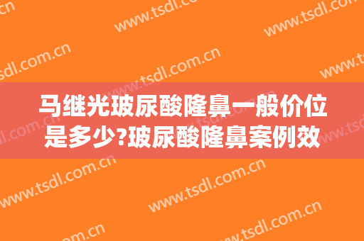 马继光玻尿酸隆鼻一般价位是多少?玻尿酸隆鼻案例效果对比图_中国医学科学院整形外科医院