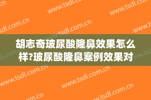 胡志奇玻尿酸隆鼻效果怎么样?玻尿酸隆鼻案例效果对比图_南方医科大学南方医院