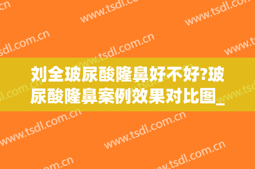 刘全玻尿酸隆鼻好不好?玻尿酸隆鼻案例效果对比图_四川省医学科学院·四川省人民医院