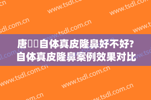 唐玥玓自体真皮隆鼻好不好?自体真皮隆鼻案例效果对比图_四川大学华西医院