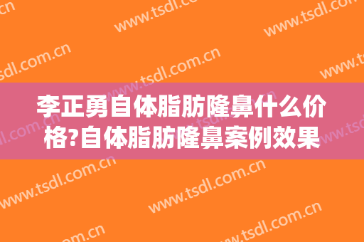 李正勇自体脂肪隆鼻什么价格?自体脂肪隆鼻案例效果对比图_四川大学华西医院