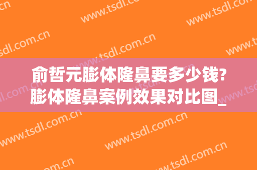 俞哲元膨体隆鼻要多少钱?膨体隆鼻案例效果对比图_上海交通大学医学院附属第九人民医院