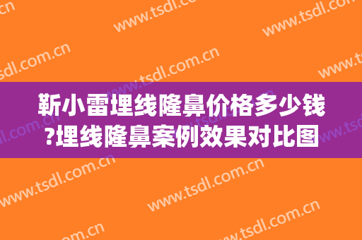 靳小雷埋线隆鼻价格多少钱?埋线隆鼻案例效果对比图_中国医学科学院整形外科医院