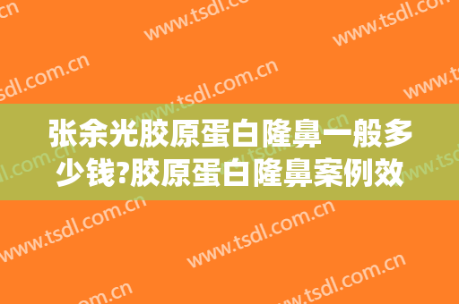 张余光胶原蛋白隆鼻一般多少钱?胶原蛋白隆鼻案例效果对比图_上海交通大学医学院附属第九人民医院