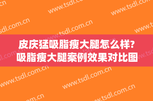 皮庆猛吸脂瘦大腿怎么样?吸脂瘦大腿案例效果对比图_上海交通大学医学院附属仁济医院