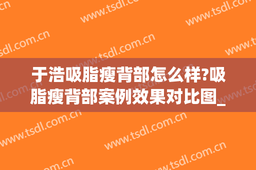 于浩吸脂瘦背部怎么样?吸脂瘦背部案例效果对比图_中国医学科学院整形外科医院
