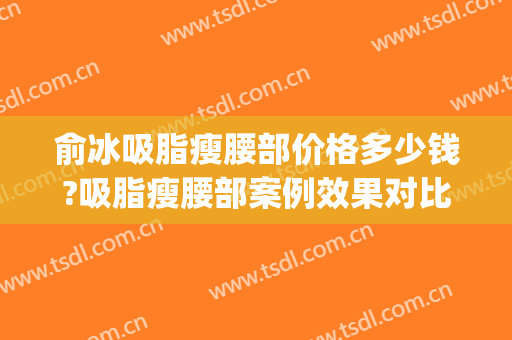 俞冰吸脂瘦腰部价格多少钱?吸脂瘦腰部案例效果对比图_中国医学科学院整形外科医院