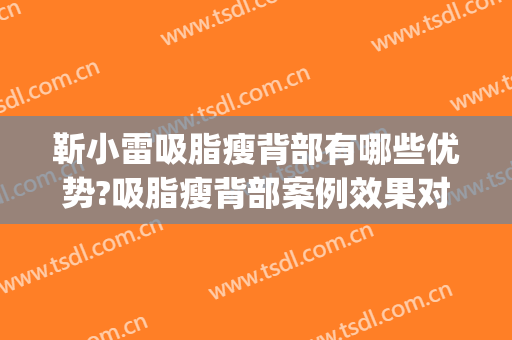靳小雷吸脂瘦背部有哪些优势?吸脂瘦背部案例效果对比图_中国医学科学院整形外科医院