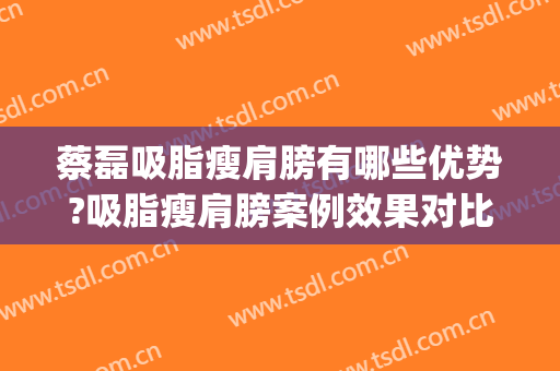蔡磊吸脂瘦肩膀有哪些优势?吸脂瘦肩膀案例效果对比图_中国医学科学院整形外科医院