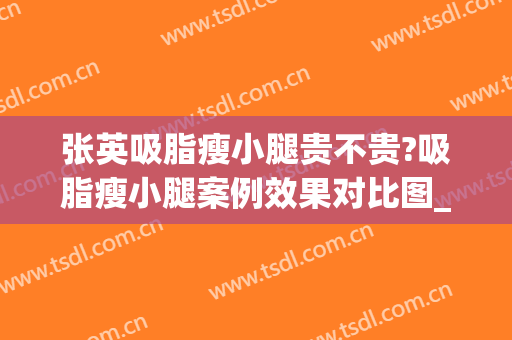 张英吸脂瘦小腿贵不贵?吸脂瘦小腿案例效果对比图_上海交通大学医学院附属第九人民医院