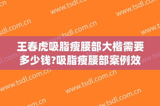王春虎吸脂瘦腰部大楷需要多少钱?吸脂瘦腰部案例效果对比图_中国医学科学院整形外科医院