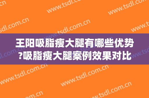 王阳吸脂瘦大腿有哪些优势?吸脂瘦大腿案例效果对比图_中国医学科学院北京协和医院