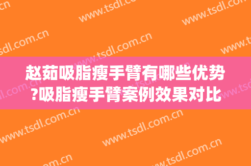 赵茹吸脂瘦手臂有哪些优势?吸脂瘦手臂案例效果对比图_中国医学科学院北京协和医院
