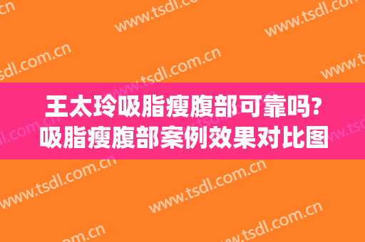 王太玲吸脂瘦腹部可靠吗?吸脂瘦腹部案例效果对比图_中国医学科学院整形外科医院