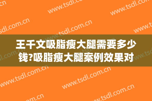 王千文吸脂瘦大腿需要多少钱?吸脂瘦大腿案例效果对比图_中国医学科学院整形外科医院